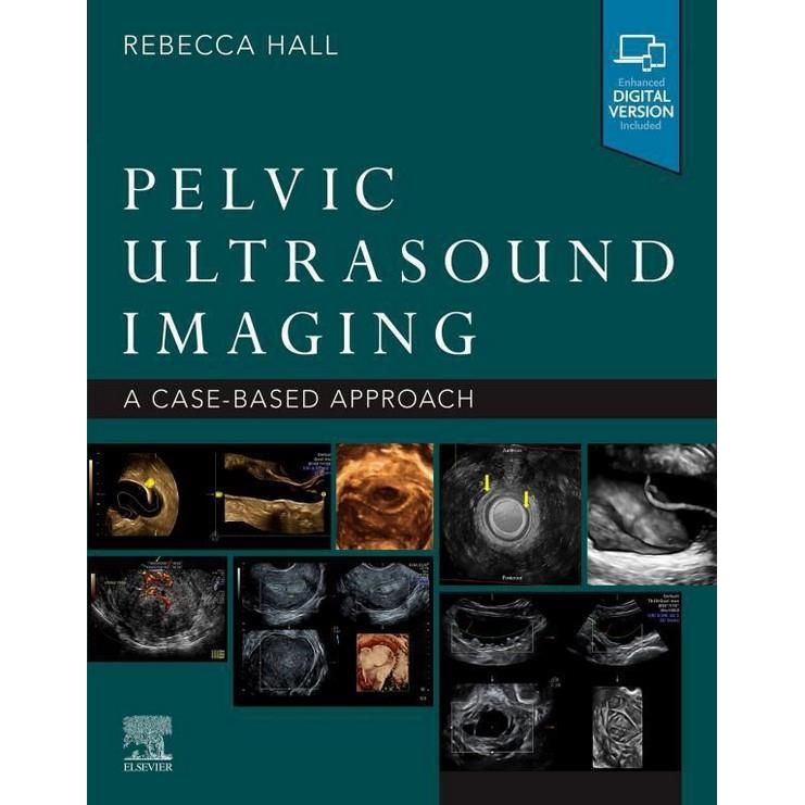 Pelvic Ultrasound Imaging