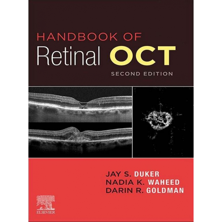 Handbook of Retinal OCT Optical Coherence Tomography, 2nd Edition