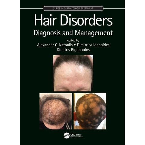 Hair Disorders Diagnosis and Management