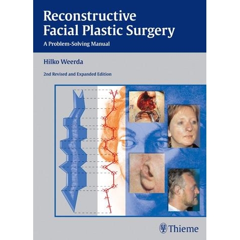 Reconstructive Facial Plastic Surgery, A Problem-Solving Manual, 2nd Edition