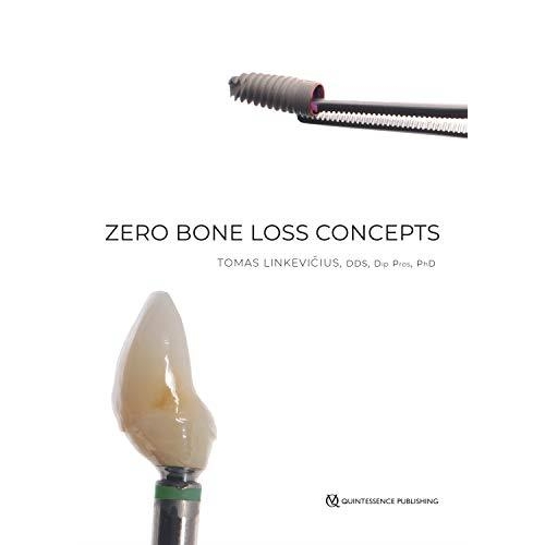 Zero Bone Loss Concepts