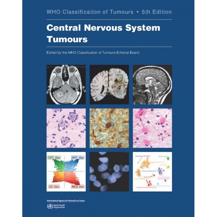 WHO Classification of Tumours of the Central Nervous System 5e 2022