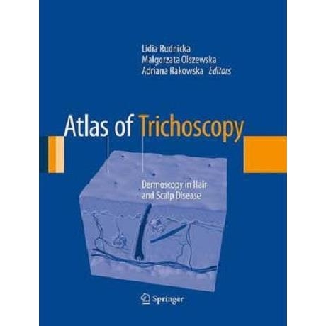 Atlas of Trichoscopy Dermoscopy in Hair and Scalp Disease