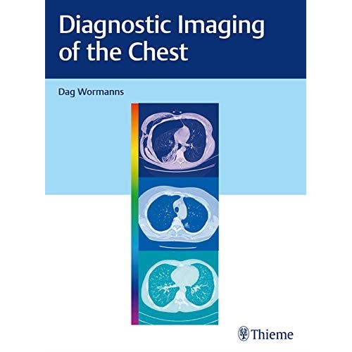 Diagnostic Imaging of the Chest