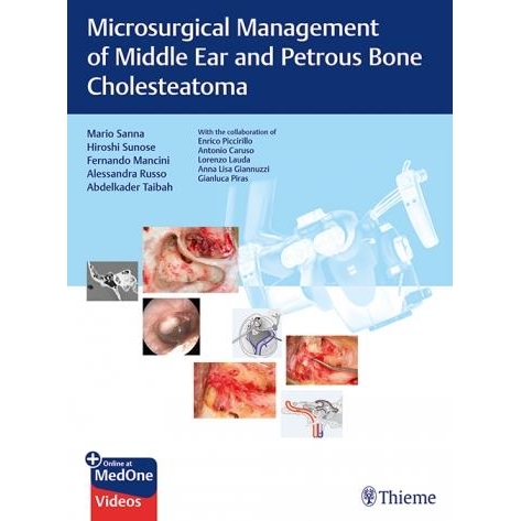 Microsurgical Management of Middle Ear and Petrous Bone Cholesteatoma