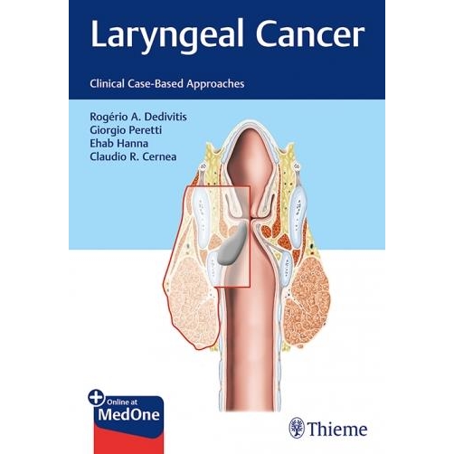 Laryngeal Cancer Dedivitis