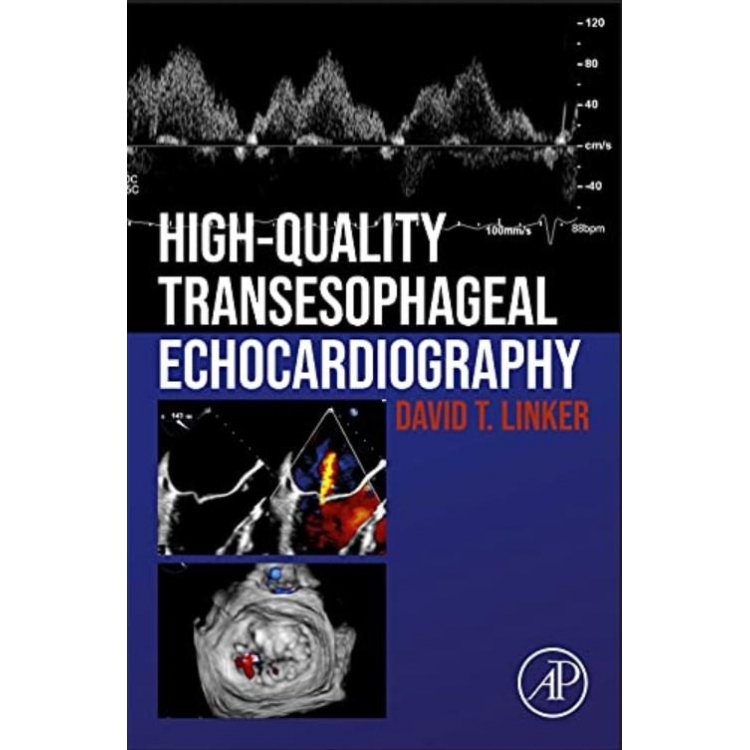 High-Quality Transesophageal Echocardiography
