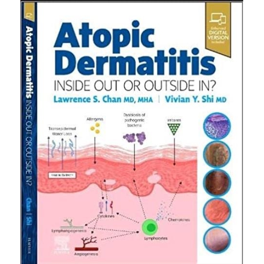 Atopic Dermatitis: Inside Out or Outside In