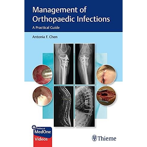 Management of Orthopaedic Infections A Practical Guide