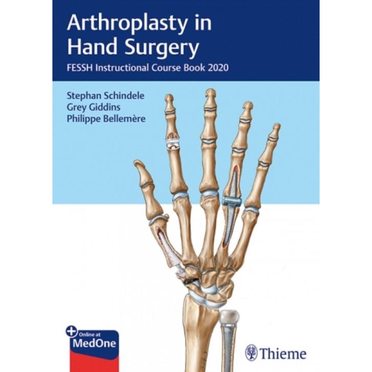 Arthroplasty in Hand Surgery FESSH Instructional Course Book 2020