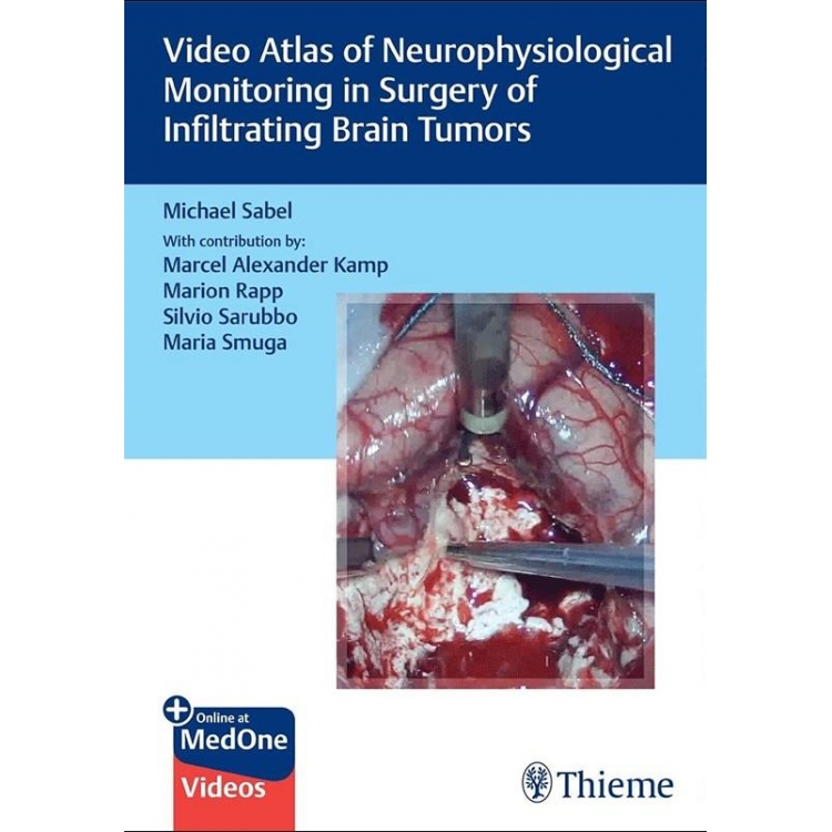 Video Atlas of Neurophysiological Monitoring in Surgery of Infiltrating Brain Tumors