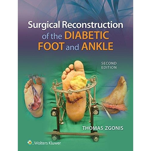 Surgical Reconstruction of the Diabetic Foot and Ankle