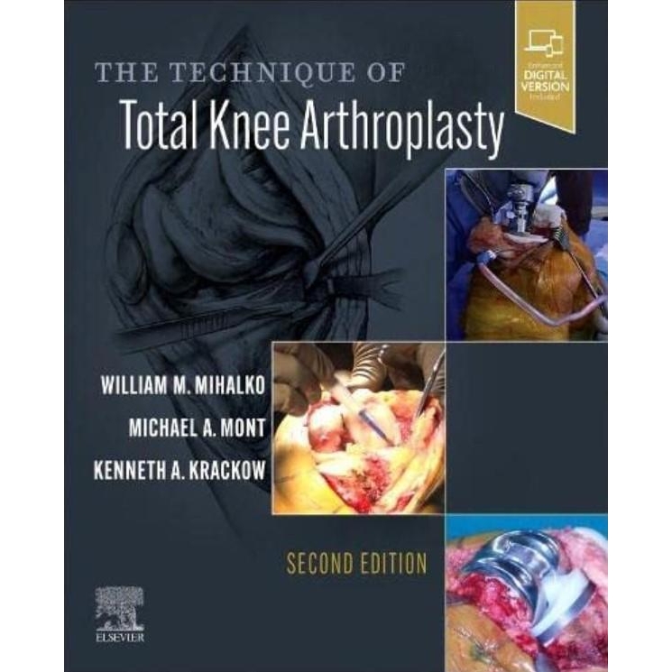 The Technique of Total Knee Arthroplasty, 2nd Edition