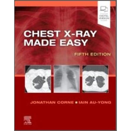Chest X-Ray Made Easy, 5th Edition