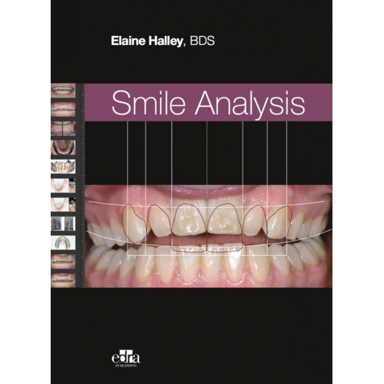 Smile Analysis