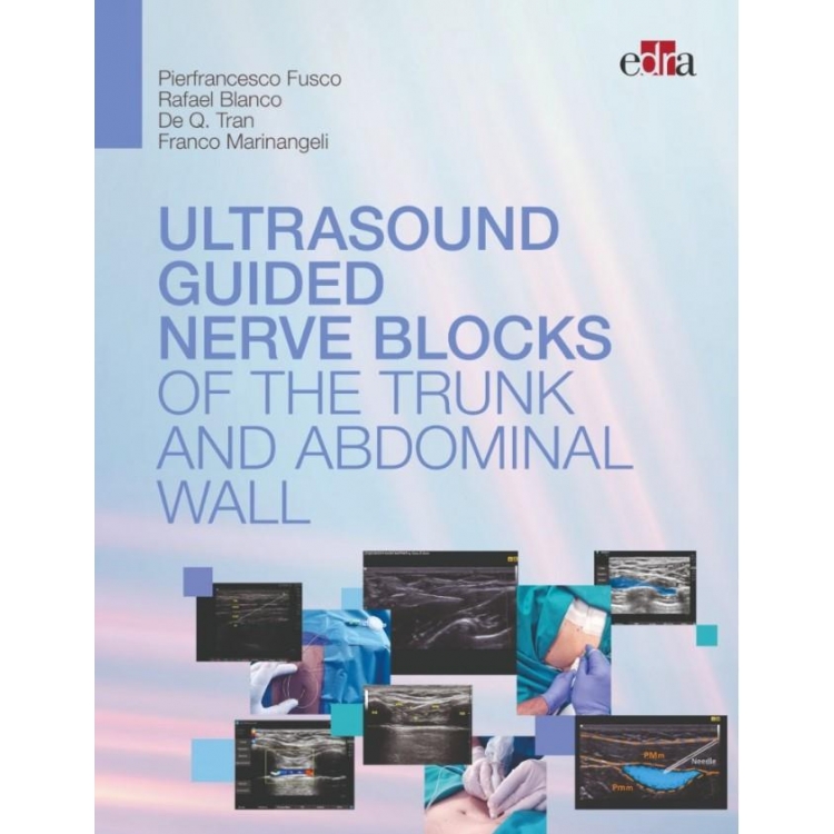 Ultrasound Guided Nerve Blocks of the Trunk and Abdominal Wall, 1st Edition