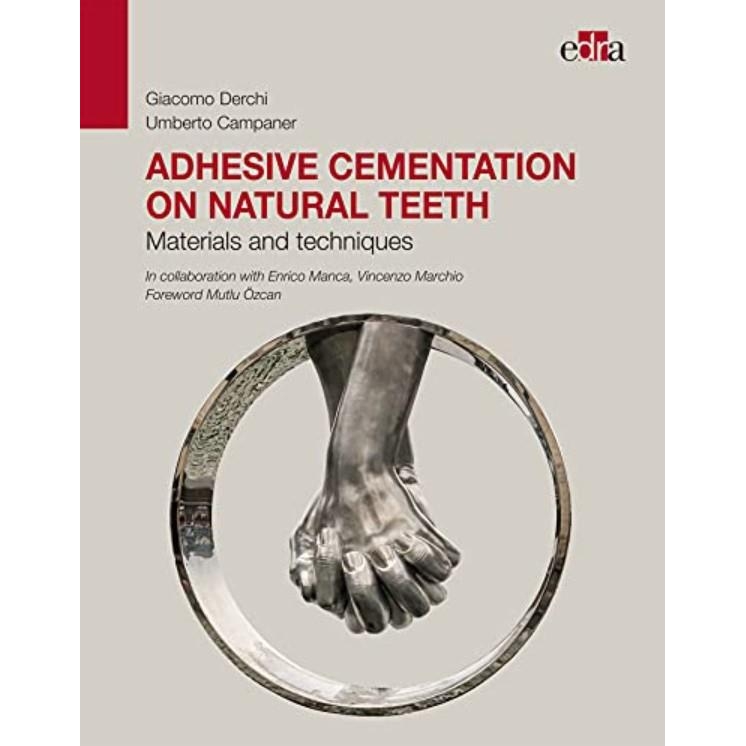 Adhesive cementation on natural teeth. Materials and techniques 1st Edition