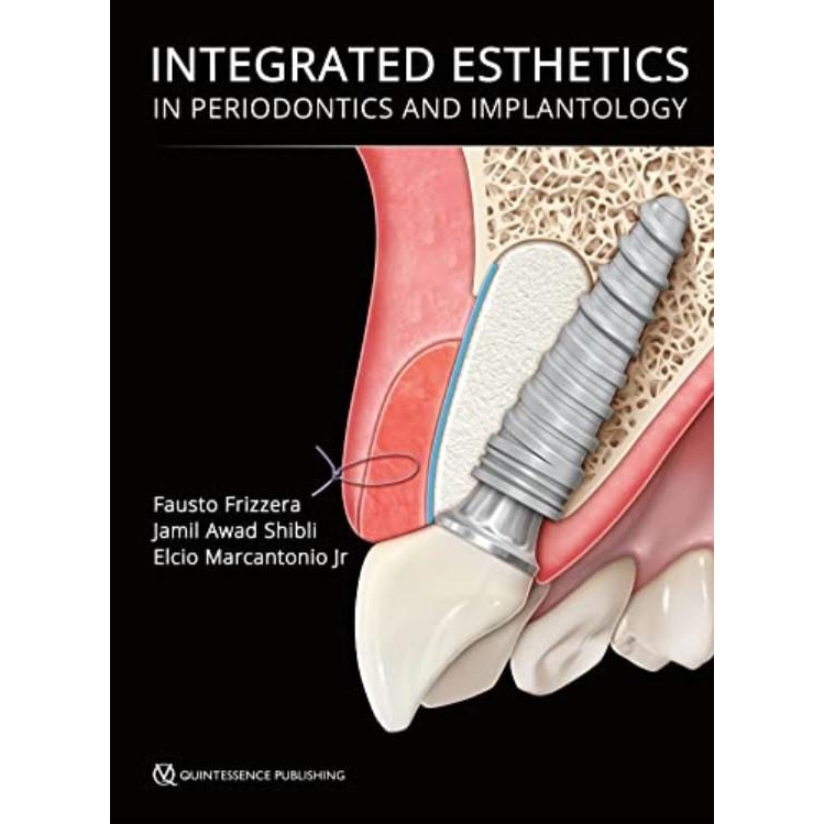 Integrated Esthetics in Periodontics and Implantology