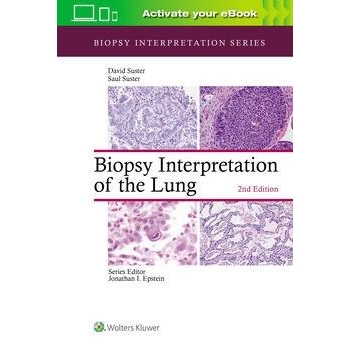 Biopsy Interpretation of the Lung, 2nd Edition