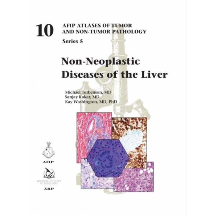 Non-Neoplastic Diseases of the Liver