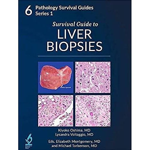 Survival Guide to Liver Biopsies
