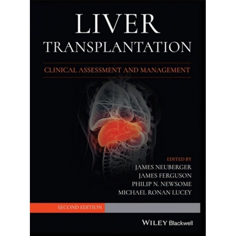 Liver Transplantation: Clinical Assessment and Management, 2nd Edition