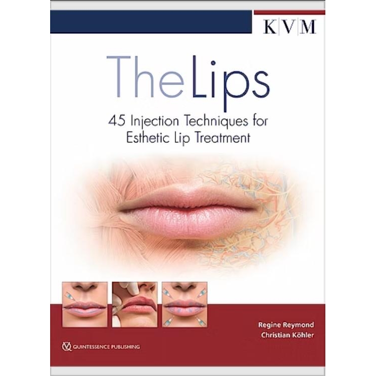 The Lips: 45 Injection Techniques for Esthetic Lip Treatment