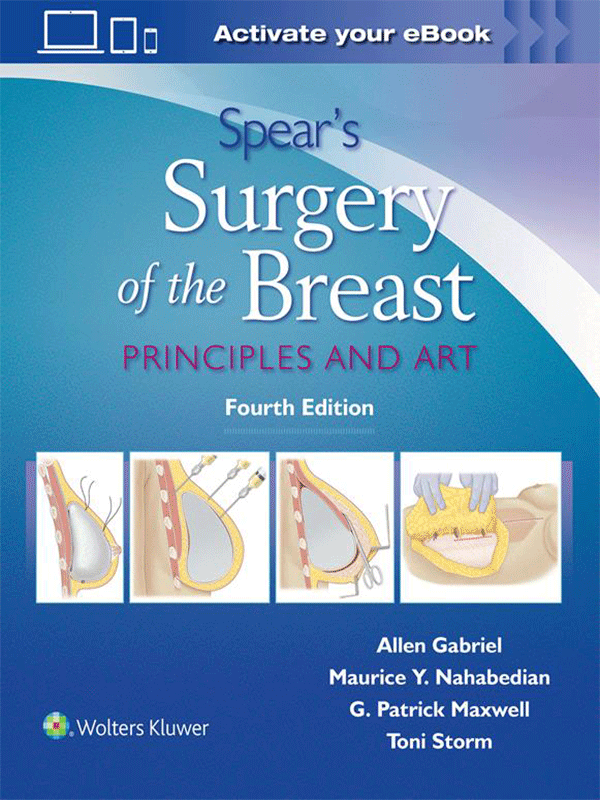 Spear`s Surgery of the Breast: Principles and Art, 4th Edition