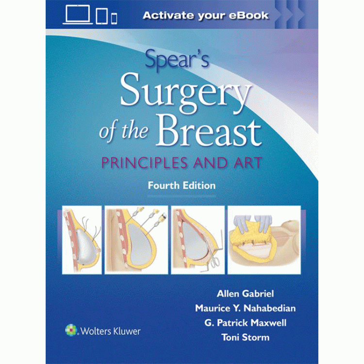 Spear`s Surgery of the Breast: Principles and Art, 4th Edition