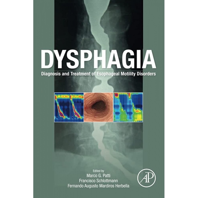 Dysphagia: Diagnosis and Treatment of Esophageal Motility Disorders