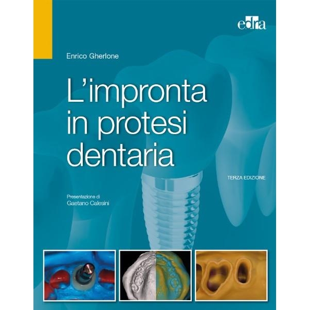 L`impronta in protesi dentaria, 4th Εdizione
