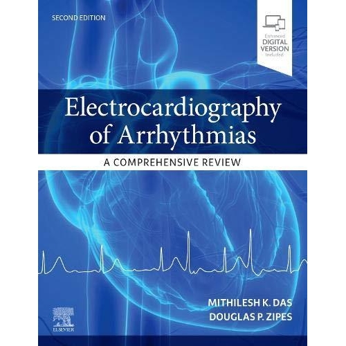 Electrocardiography of Arrhythmias: A Comprehensive Review: A Companion to Cardiac Electrophysiology, 2nd Edition