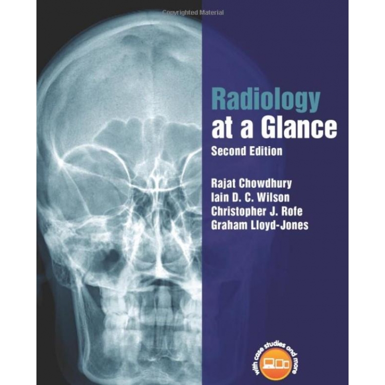 Radiology at a Glance, 2nd Edition