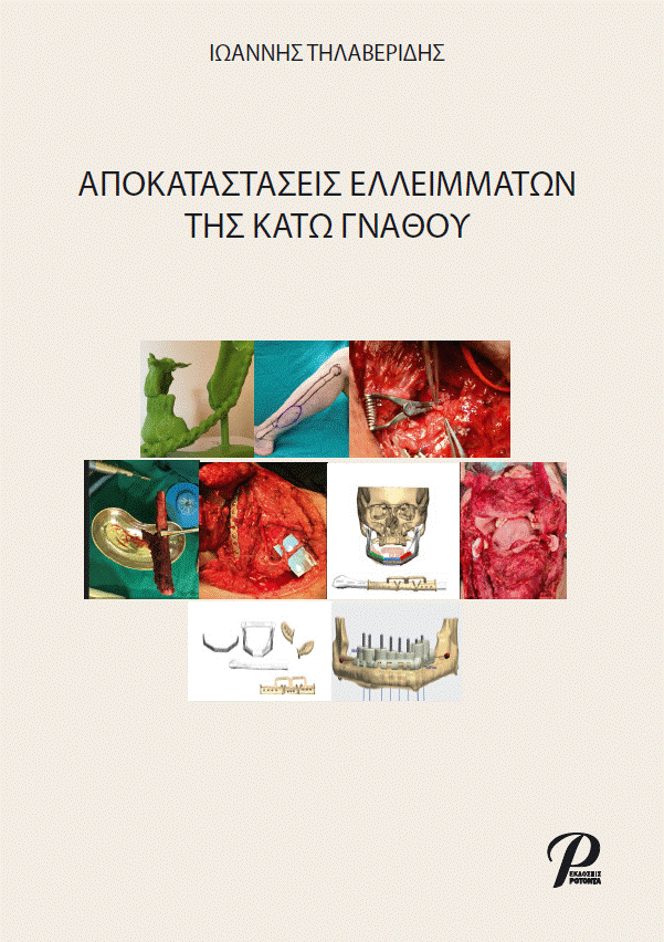 Αποκαταστάσεις Eλλειμάτων της Kάτω Γνάθου