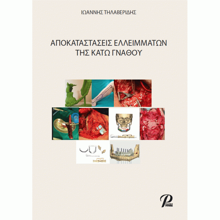 Αποκαταστάσεις Eλλειμάτων της Kάτω Γνάθου