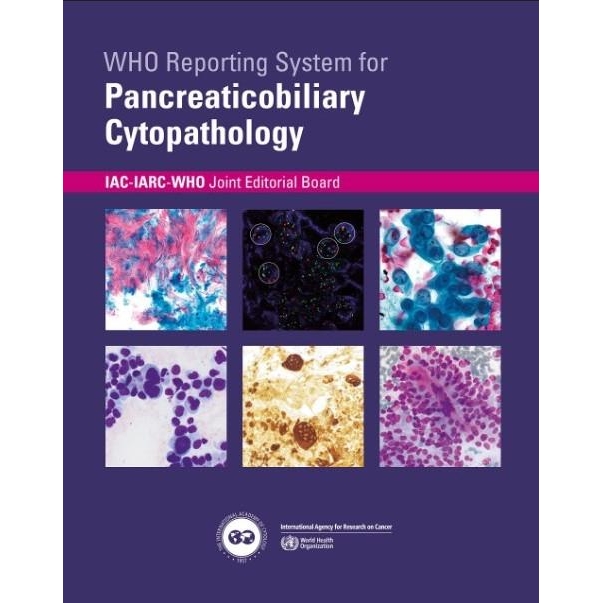 WHO Reporting System for Pancreaticobiliary Cytopathology