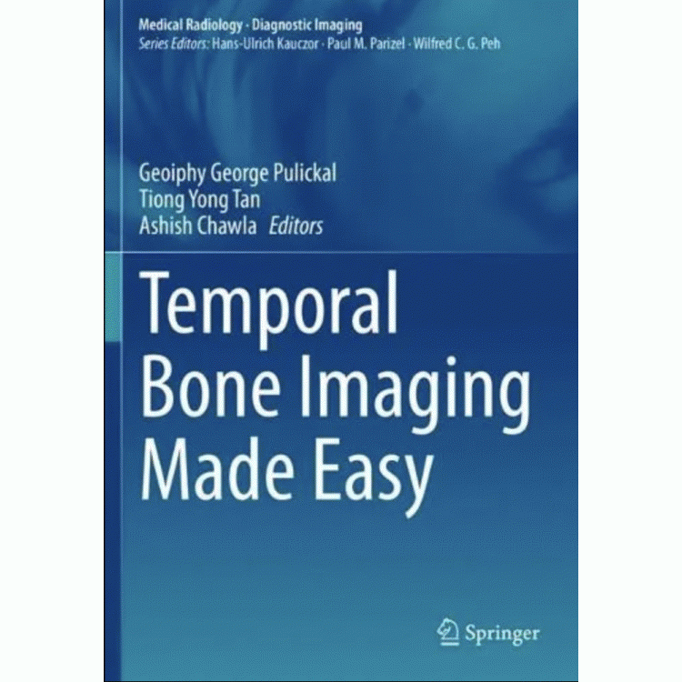 Temporal Bone Imaging Made Easy