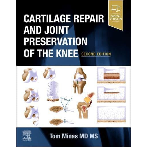 Cartilage Repair and Joint Preservation of the Knee, 2nd Edition