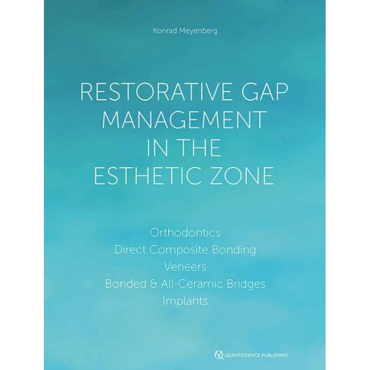 Restorative Gap Management in the Esthetic Zone, 1st Edition