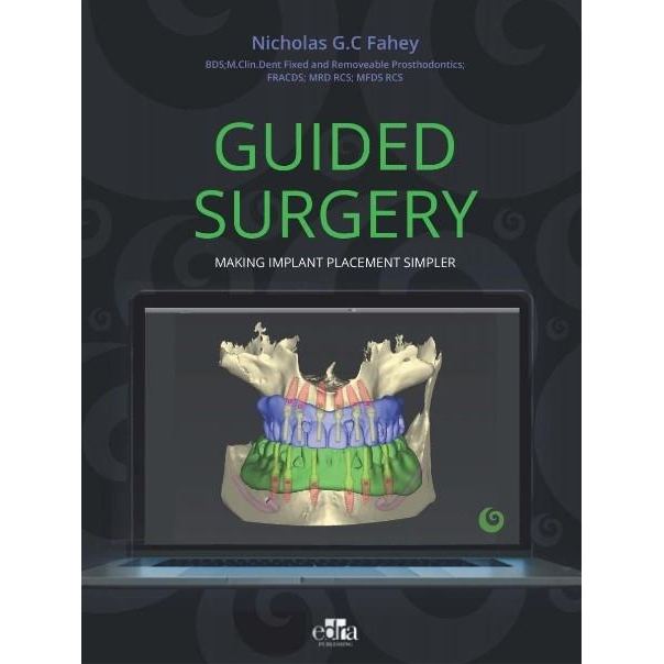 Guided Surgery, 1st Edition