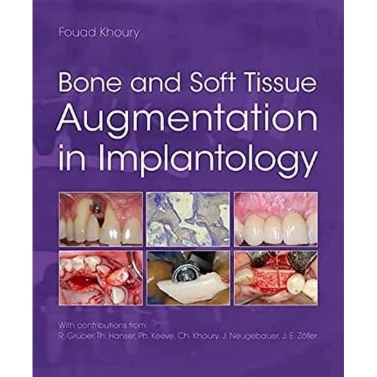 Bone and Soft Tissue Augmentation in Implantology, 1st Edition