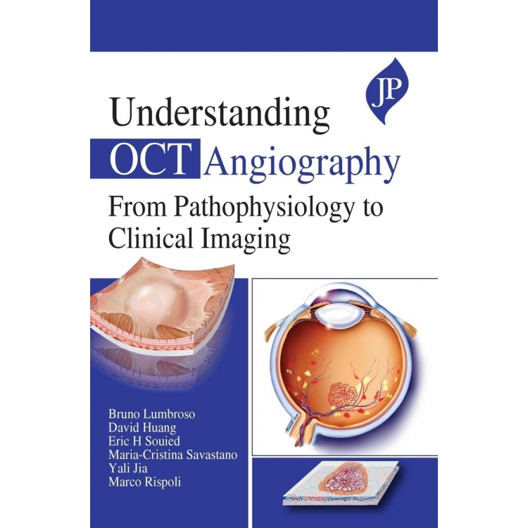 Understanding OCT Angiography: From Pathophysiology to Clinical Imaging