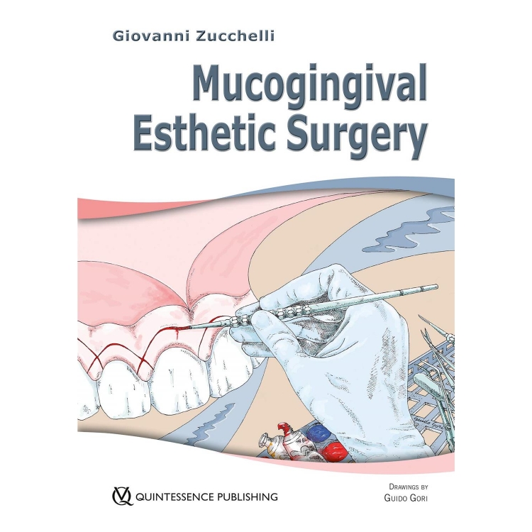 Mucogingival Esthetic Surgery, 1st Edition