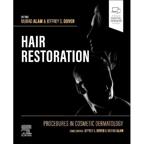 Procedures in Cosmetic Dermatology: Hair Restoration