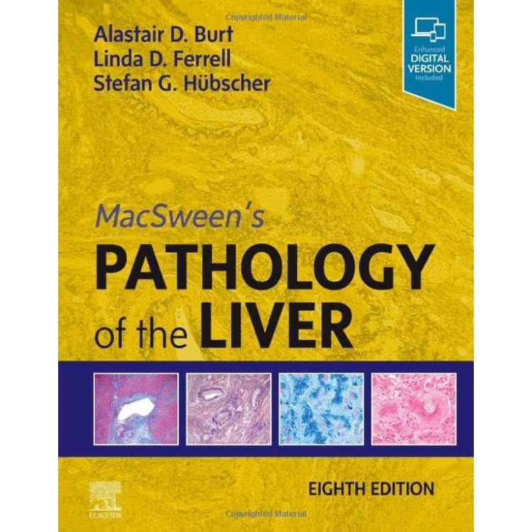 MacSween`s Pathology of the Liver, 8th Edition