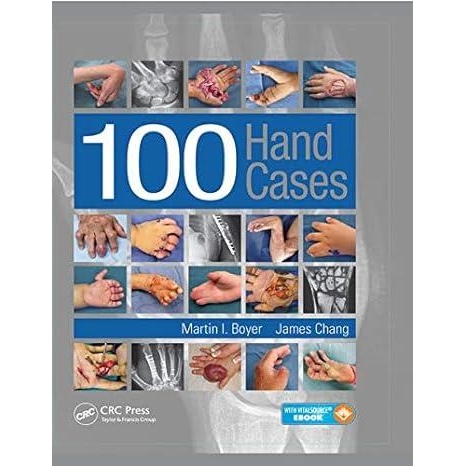 100 Hand Cases