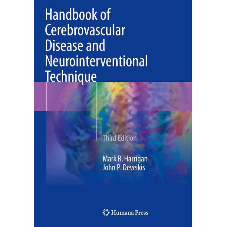 Handbook of Cerebrovascular Disease and Neurointerventional Technique, 3rd Edition