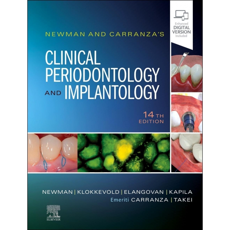Newman and Carranza`s Clinical Periodontology and Implantology, 14th Edition