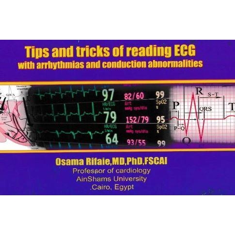 Tips and Tricks of reading ECG With arrhythmias and Conduction Abnormalities
