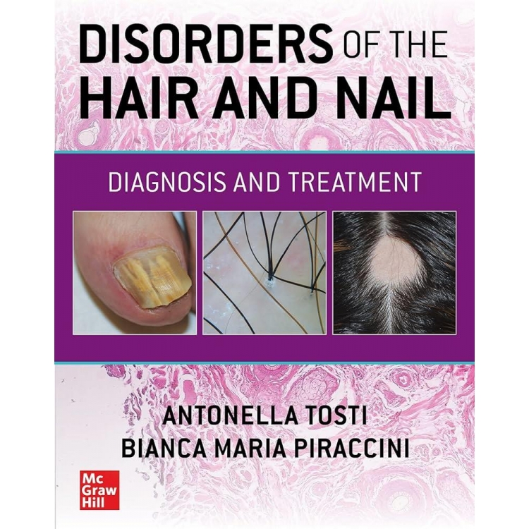 Disorders of the Hair and Nail Diagnosis and Treatment